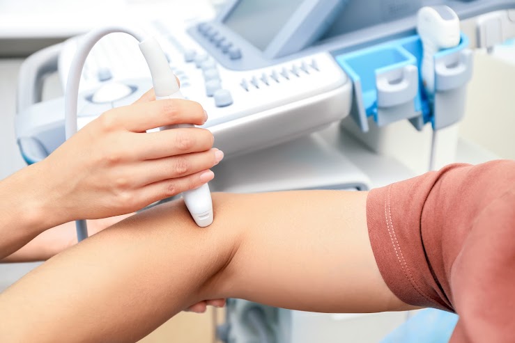 Profissional realizando doppler venoso e arterial